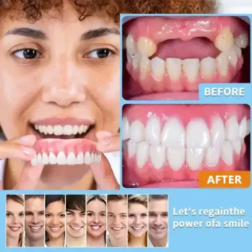 HZA™ Premium Dentures