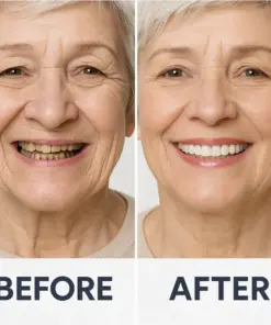 HZA™ Custom-Fit Functional Dentures