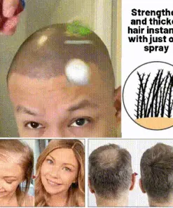 HZA™ Natural Hair Regrowth Spray