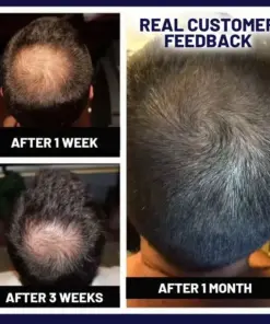 HZA™ Natural Hair Regrowth Spray