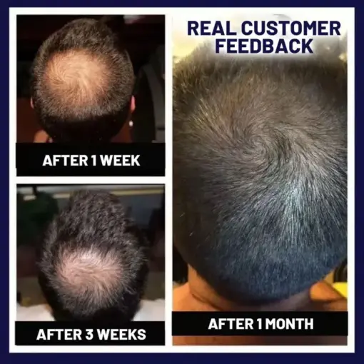 HZA™ Natural Hair Regrowth Spray