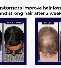 HZA™ Natural Hair Regrowth Spray