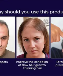 HZA™ Natural Hair Regrowth Spray