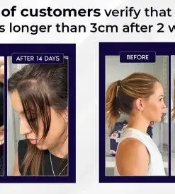 HZA™ Natural Hair Regrowth Spray